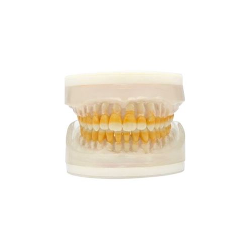 Refil Periodontia I AC 104 - Pronew