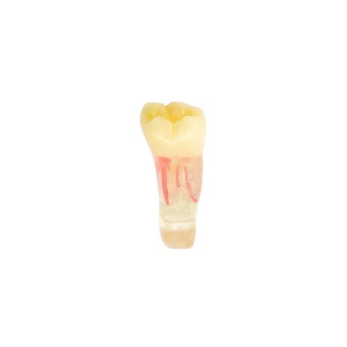 Dente 46 Endo Radiopaco para Manequim de Dentística - Pronew