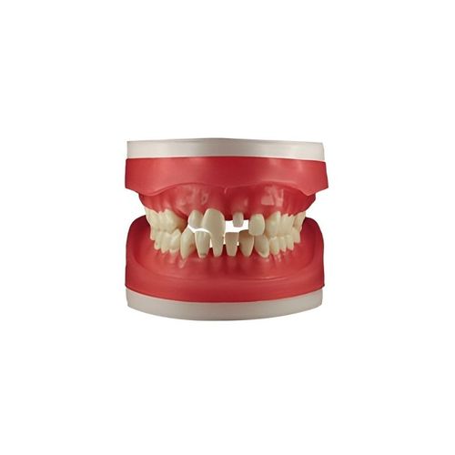 Refil de Materiais Dentarios AC100 - Pronew